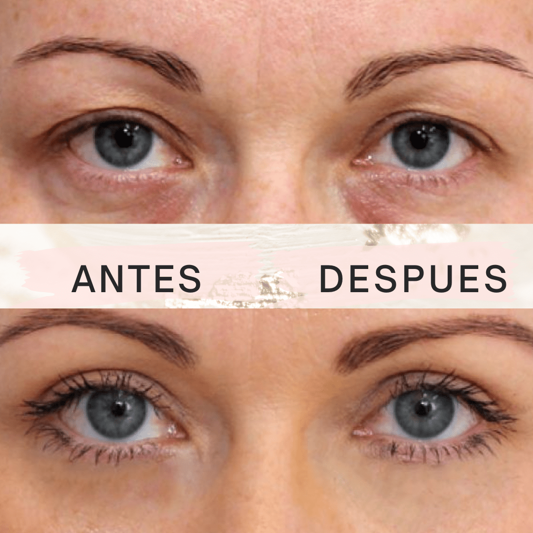 Eyelid PushUp 🤩Mirada Impactante al instante✨ 120 Pares!😱 - [PROMOCIÓN DISPONIBLE SOLO HOY]